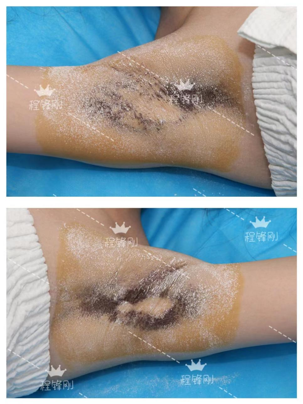 png 28C19B870FE76054F1D4C22173DC0E29.png