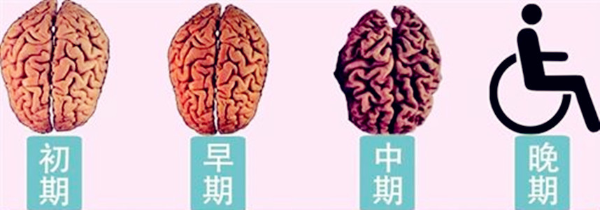 下载 (1).jpg