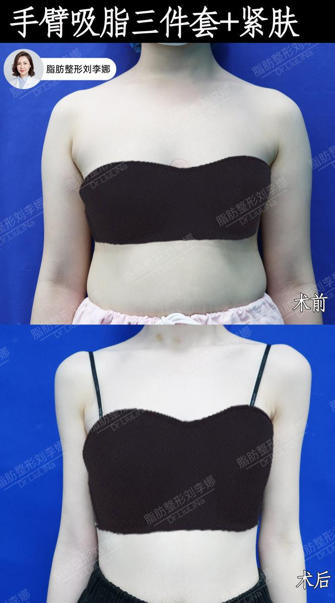 png 图片16.png
