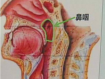 鼻咽癌症的前期症状是怎么样的