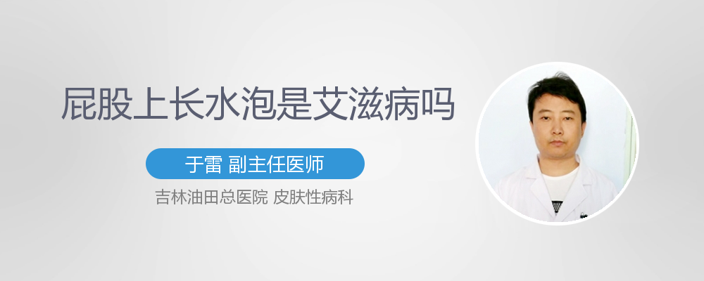 屁股上长水泡是艾滋病吗