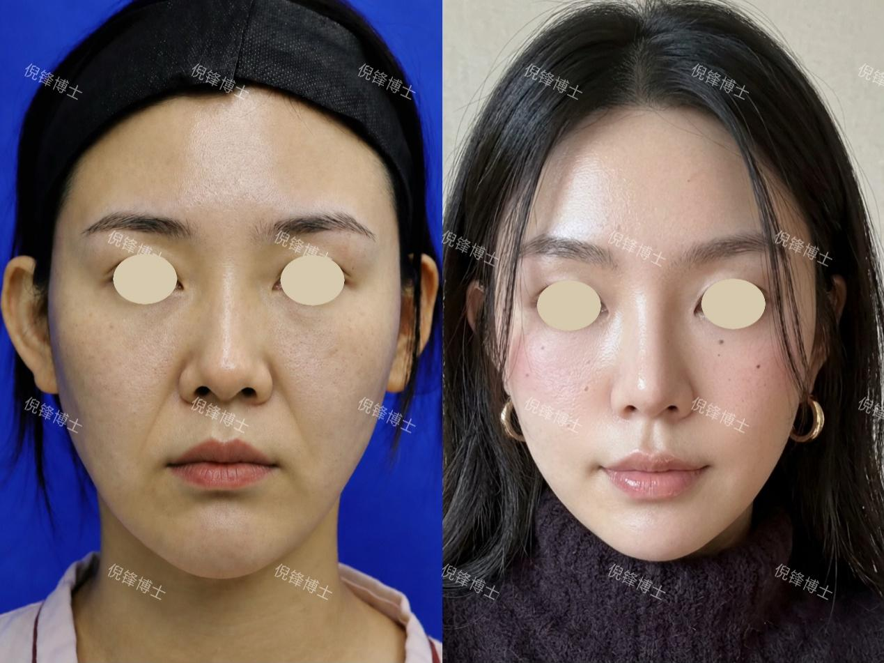 png 图片22.png