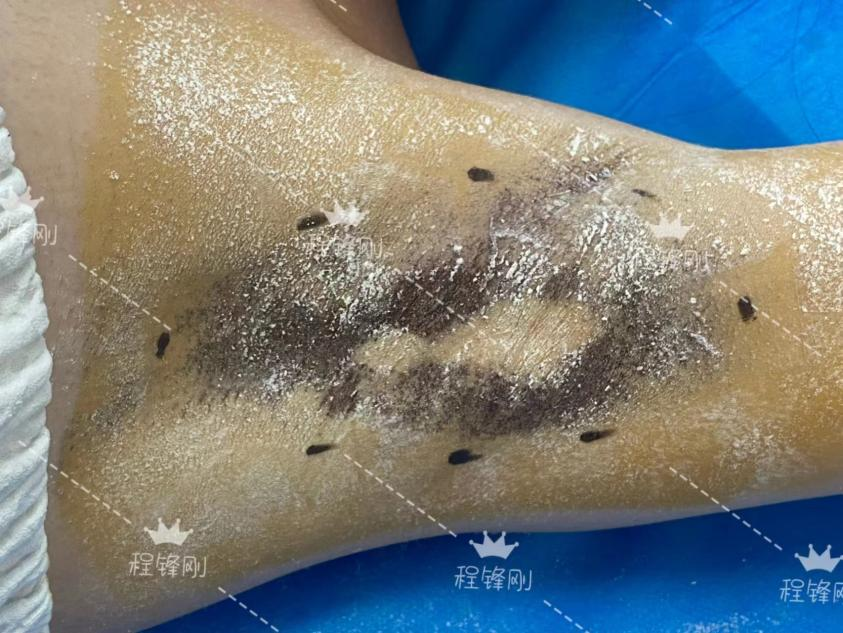 png 53225A71732D50CE7407F5F36C271441 (1).png