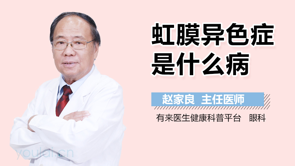 虹膜異色癥是什么病