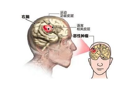 下载 (2).jpg