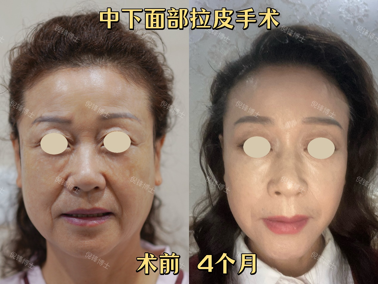 png 图片24.png