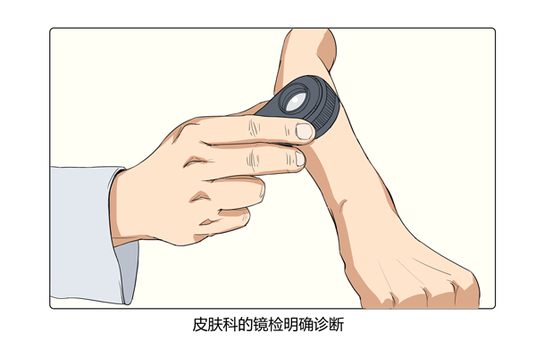 如何判断是否得了阴虱病