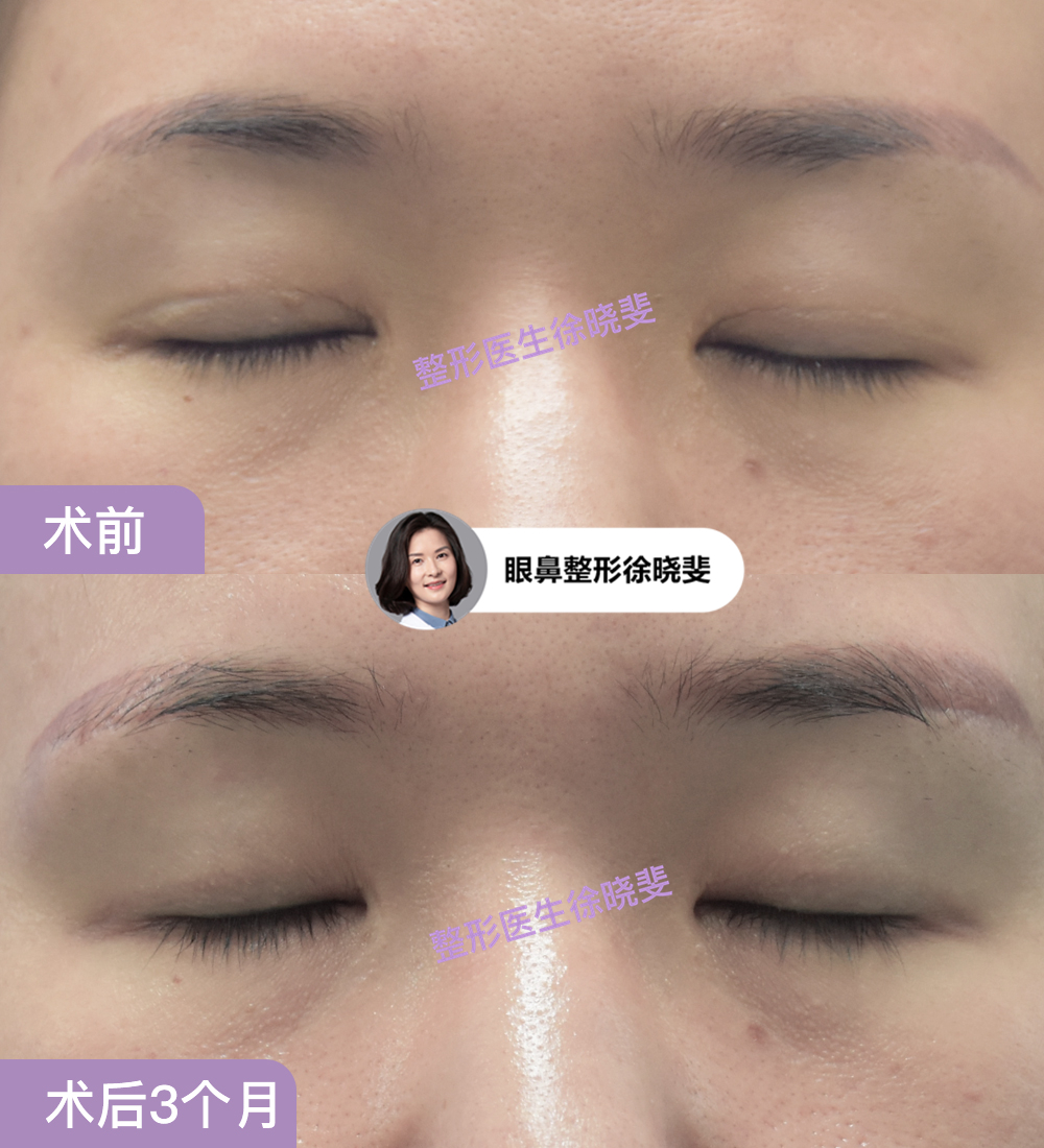 png 图片14.png
