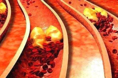 jpg u=17605718,2161993322&fm=26&gp=0.jpg