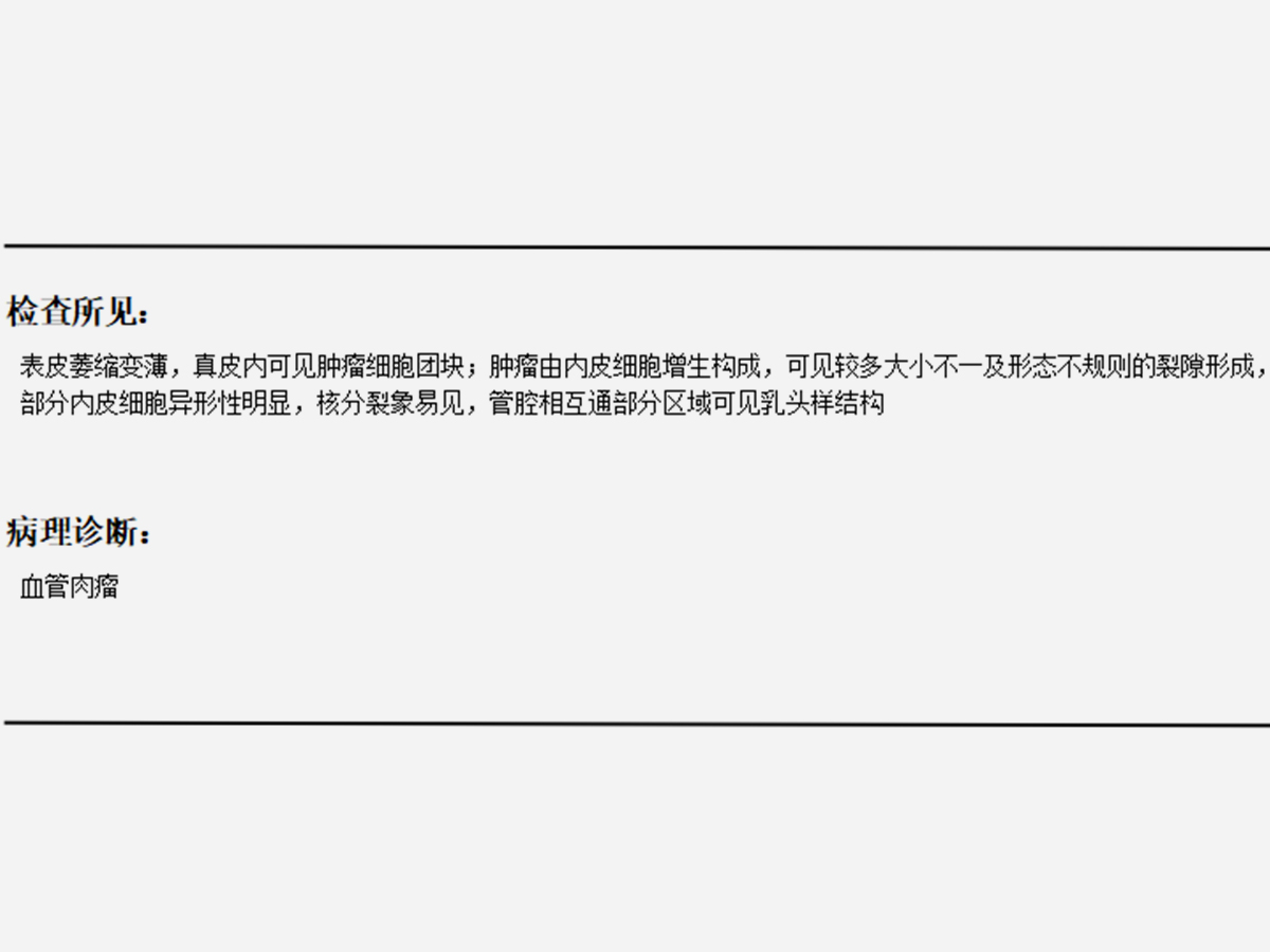 血管肉瘤（老大爺出現(xiàn)血管肉瘤，紅斑進(jìn)行性增大是信號(hào)！）.jpg