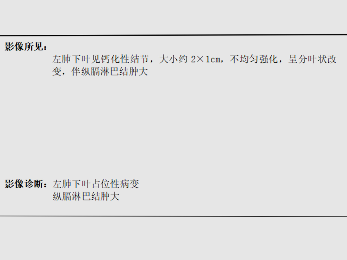 肺鱗癌（張先生確診肺鱗癌，化療+手術(shù)治療效果顯著）.png