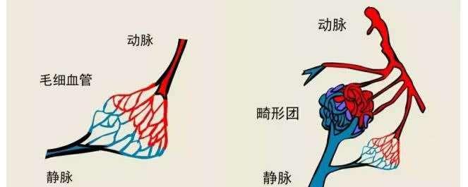 u=3880828589,3704371866&fm=11&gp=0.jpg