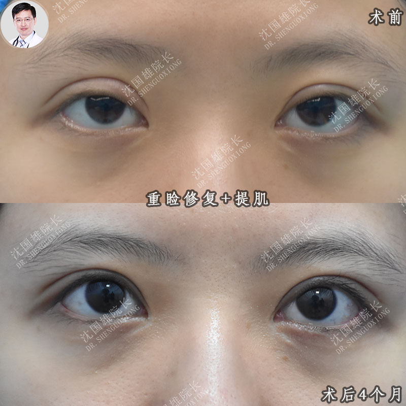 png 图片5.png