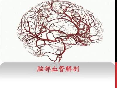 脑血管痉挛是什么病?