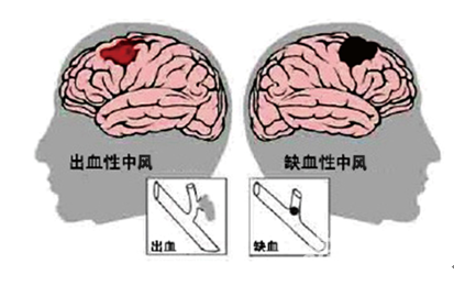 u=1635221592,2920208594&fm=26&gp=0.jpg