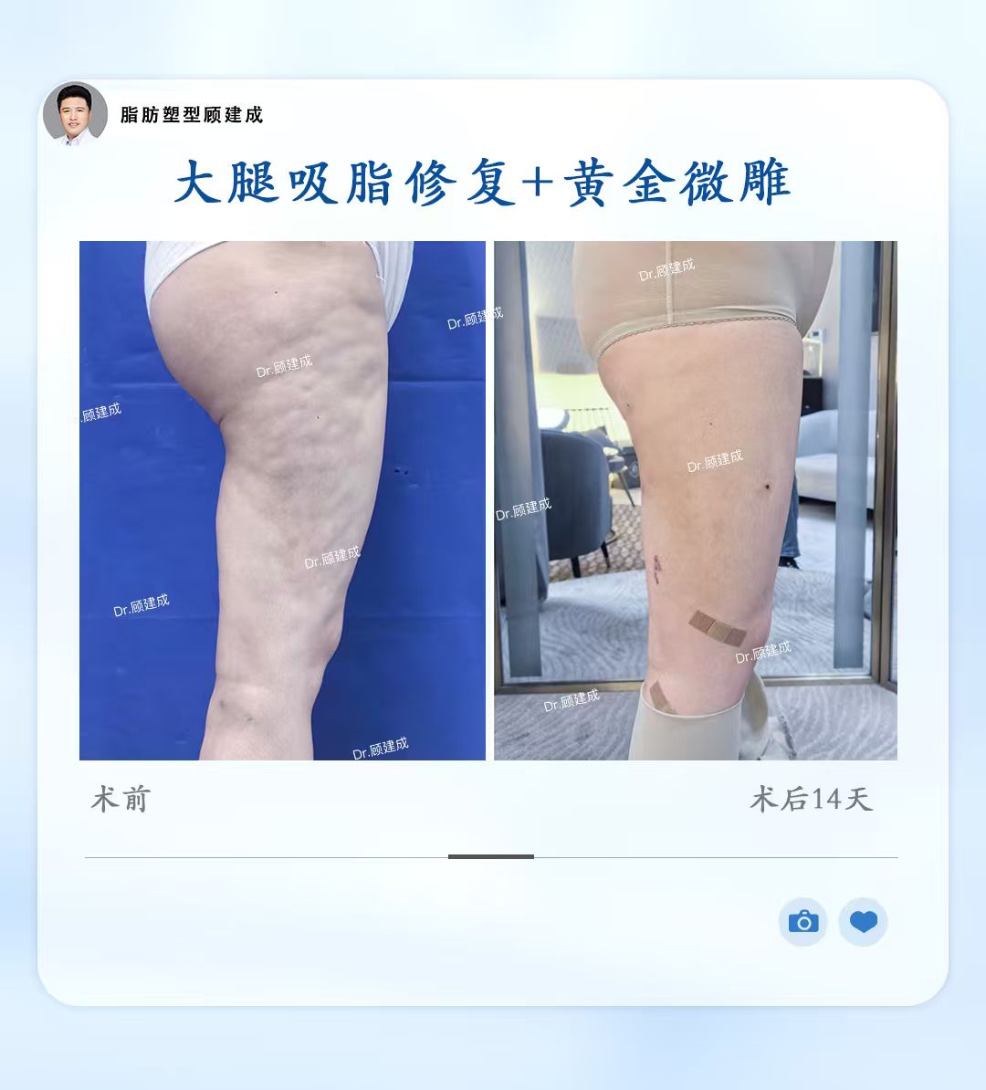 png 图片3.png