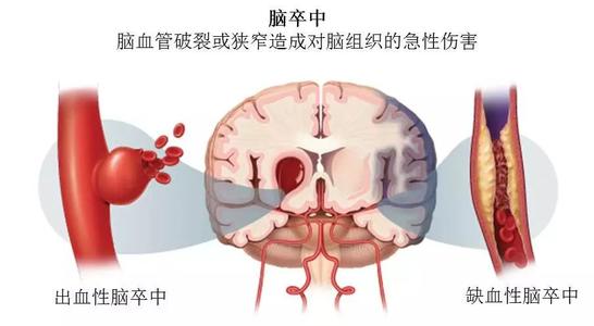 下载 (2).jpg