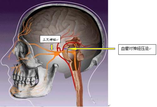 u=1209594984,1444267588&fm=26&gp=0.jpg