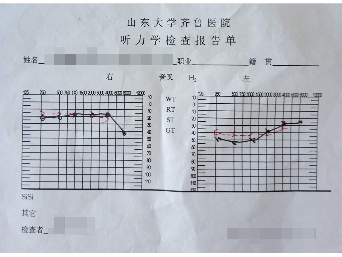 治療1個(gè)療程后聽力結(jié)果.jpg