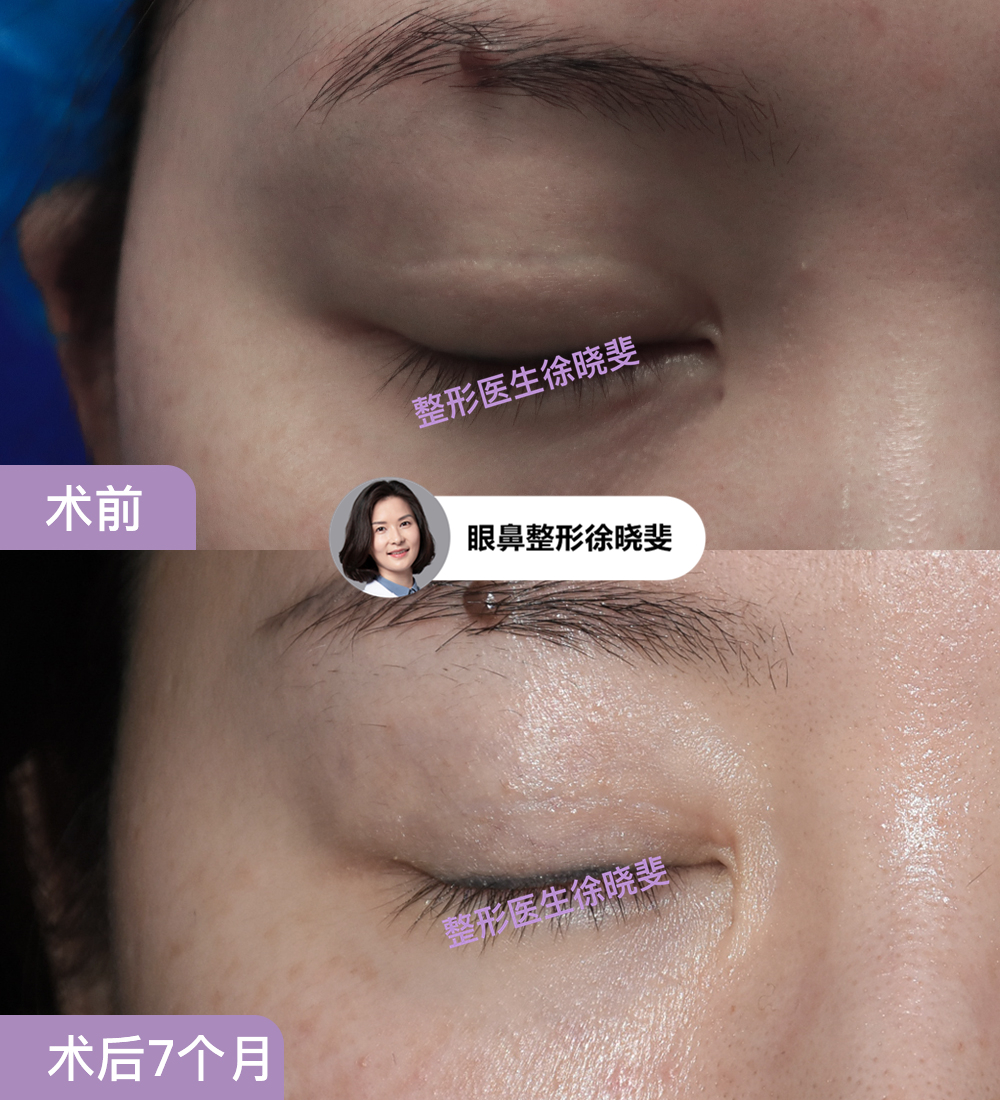 png 图片16.png
