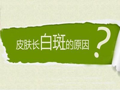 白癜风病因2.jpg