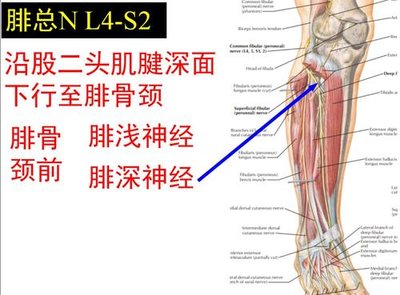 腓总神经损伤1.jpeg