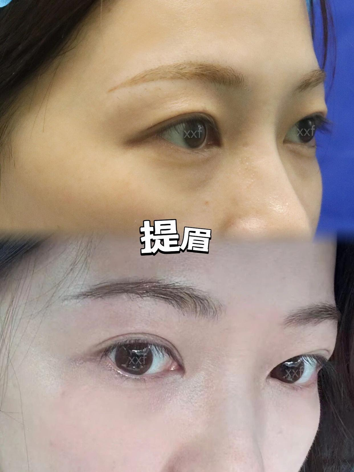 png 图片25.png