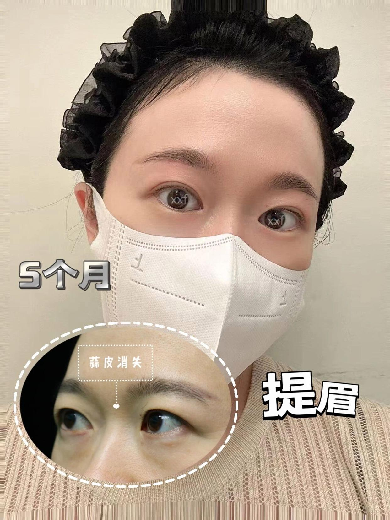 png 图片22.png