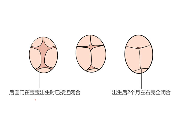 三,囟门闭合前宝宝的护理