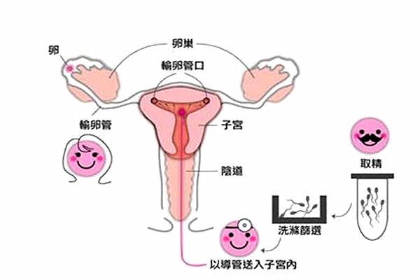 人工授精_副本.jpg