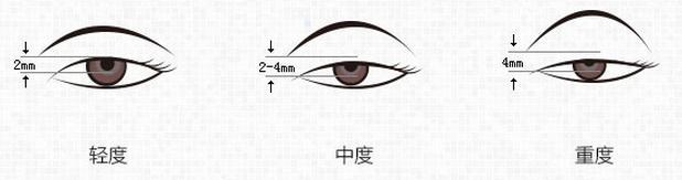 u=2059075293,417482515&fm=26&gp=0.jpg