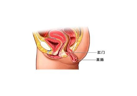 脫肛圖片 (11)