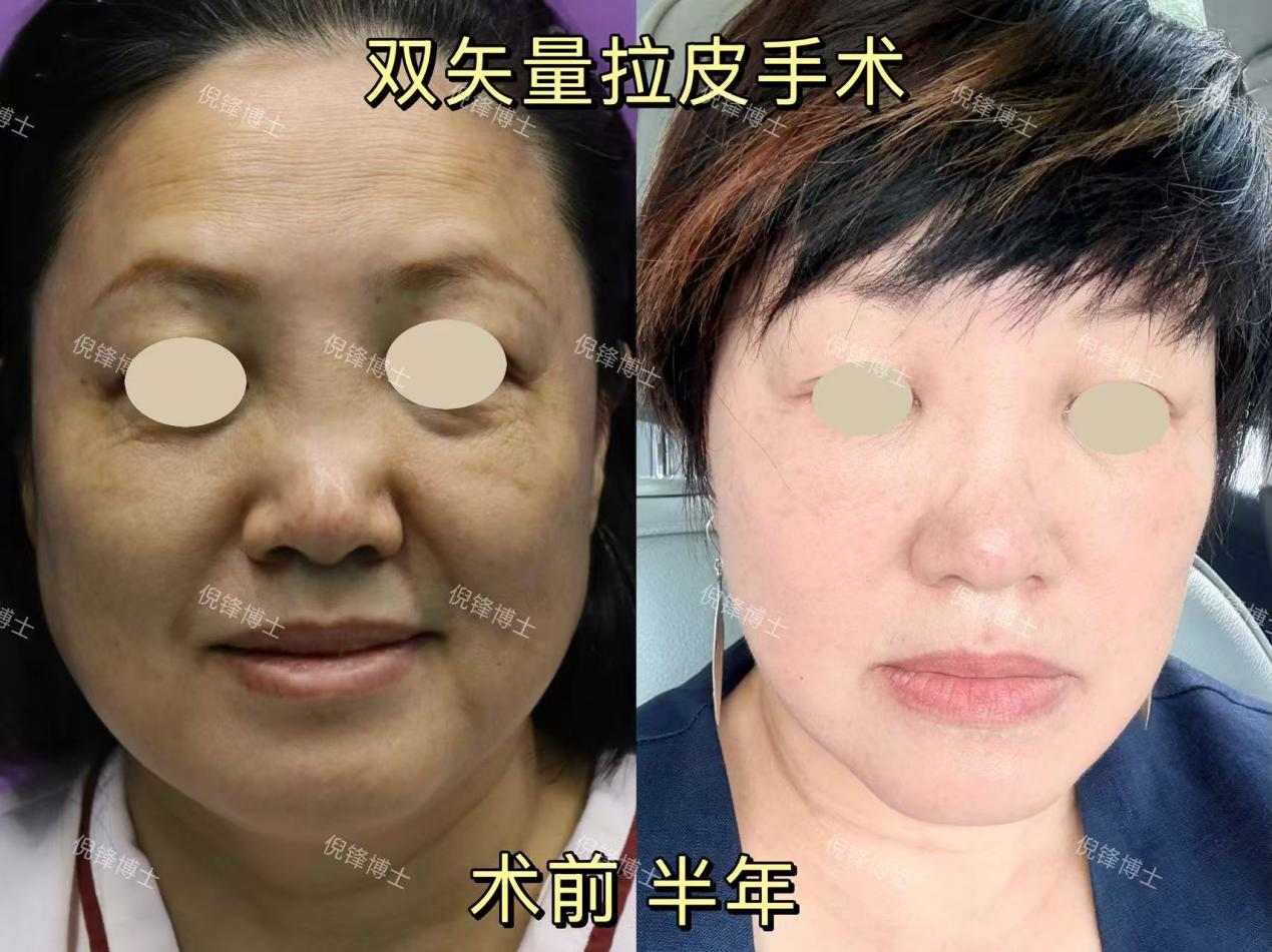 png 图片20.png