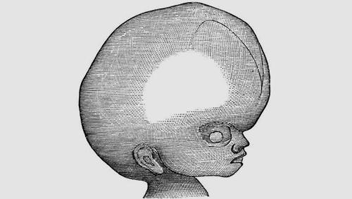 u=88322466,911992810&fm=26&gp=0.jpg