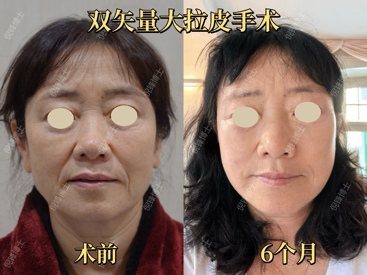 png 图片26.png
