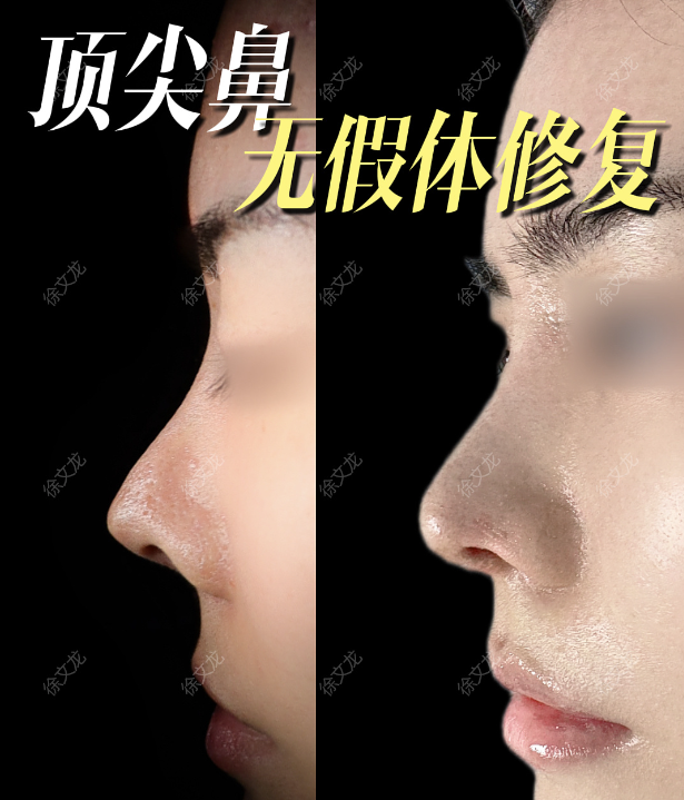 png 图片4.png