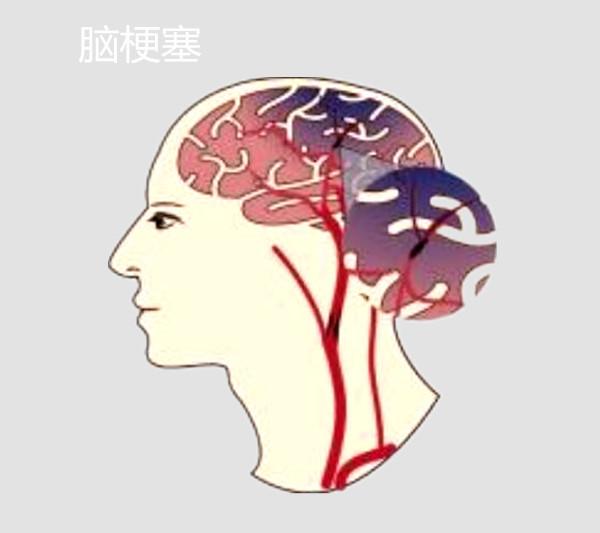 46e00003652b5f1231e6.jpg