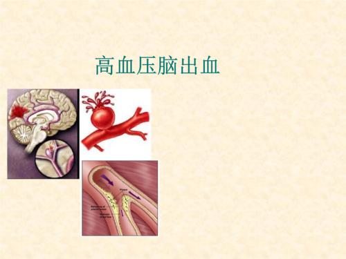 u=640590274,1720298435&fm=26&gp=0.jpg