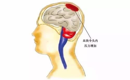 u=1007030429,992425409&fm=26&gp=0.jpg