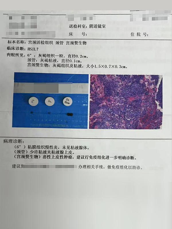 宮頸癌3.jpg