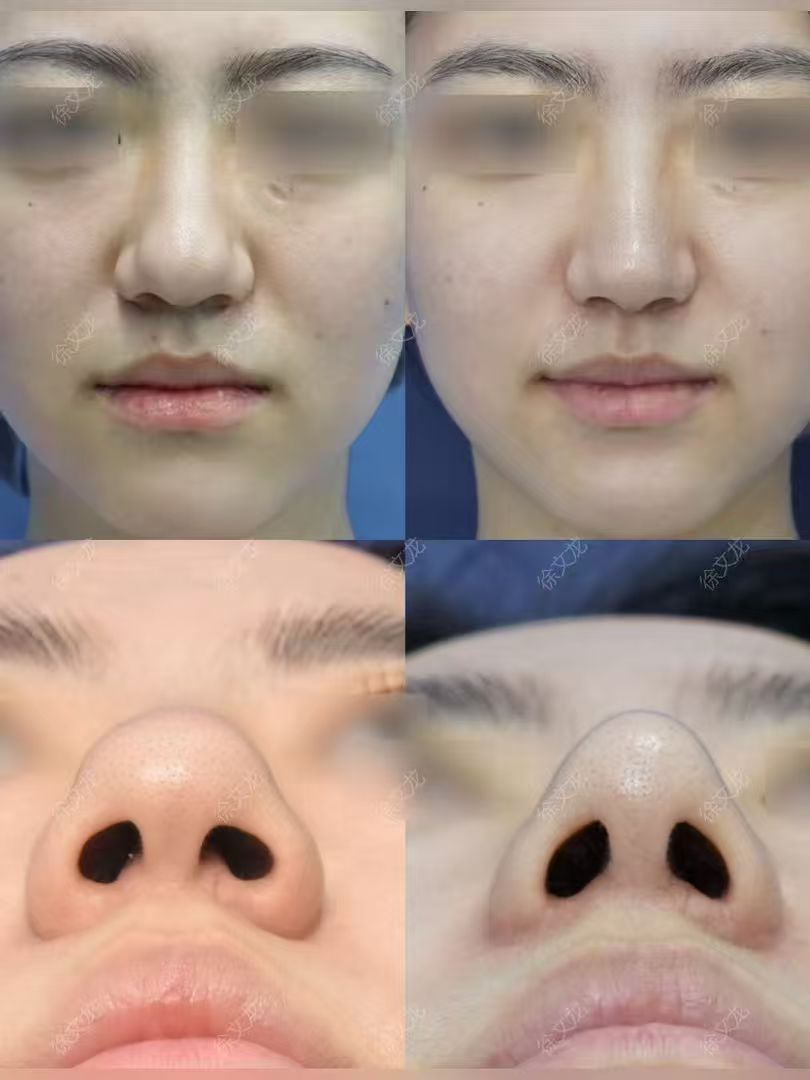png 图片1.png
