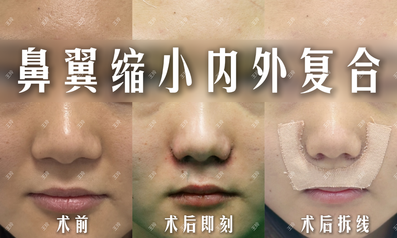 png 图片15.png