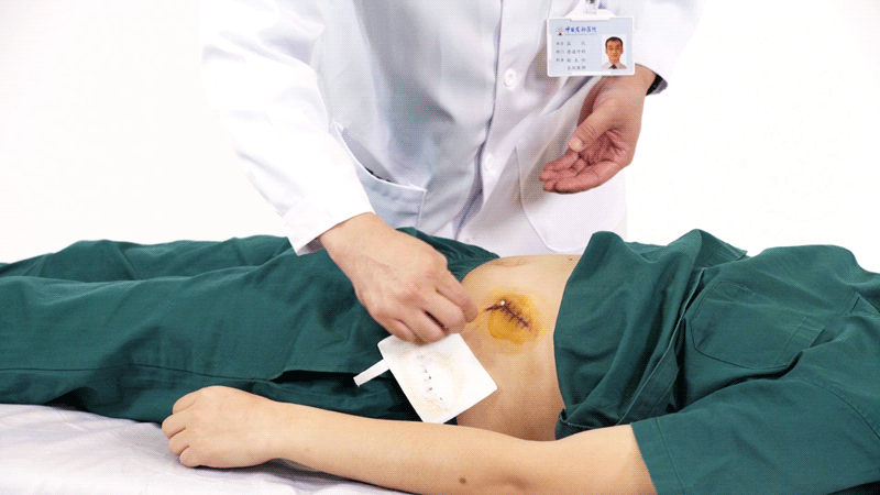 gif 伤口换药.gif