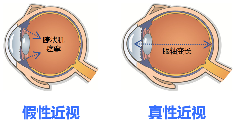 png F591FCD65170C1FCE67E10523ECAD7FD7099B287_size282_w908_h488.png