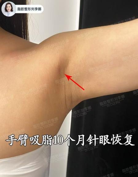 png 图片17.png