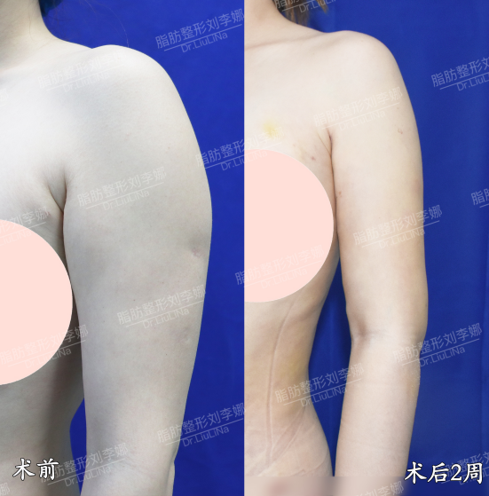 png 图片12.png