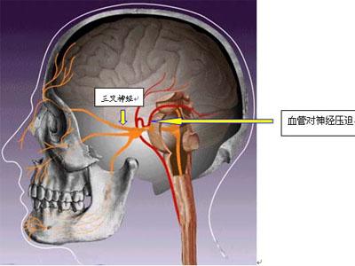 u=1397048687,3177076315&fm=26&gp=0.jpg