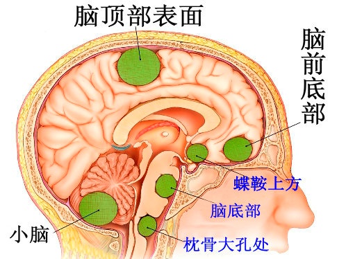 u=58544303,893059705&fm=26&gp=0.jpg