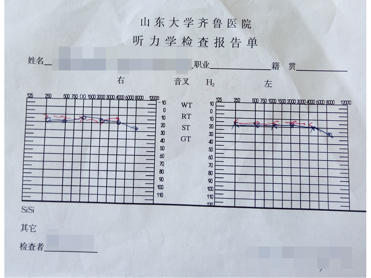 治療2個(gè)療程后聽力結(jié)果.jpg