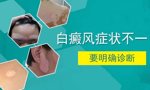白癜风症状3.jpg